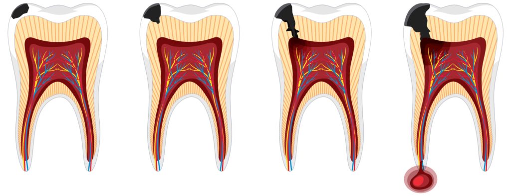 Лечение зубов в Омске Стоматология Атлант